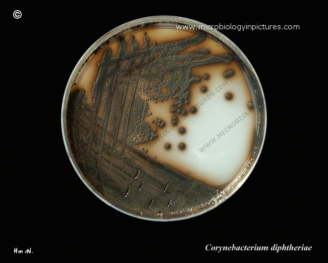 C.diphtheriae on Tinsdale agar, 72 hours c.diphtheriae colony appearance on Tinsdale agar